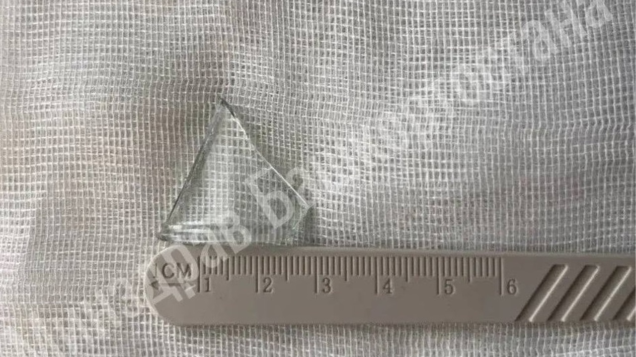 В Уфе врачи спасли мужчину, проглотившего кусок стекла В Уфе врачи спасли пациента, который случайно п...