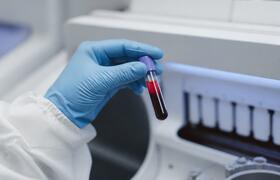 Тестирование mRNA-препаратов на донорской крови...